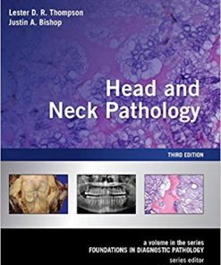(eBook PDF) Head and Neck Pathology: A Volume in the Series: Foundations in Diagnostic Pathology 3rd Edition