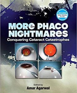 (eBook PDF) More Phaco Nightmares: Conquering Cataract Catastrophes