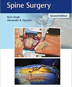 (eBook PDF) Pocket Atlas of Spine Surgery 2nd Edition by Kern Singh