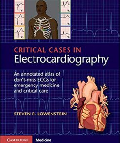 (eBook PDF) Critical Cases in Electrocardiography: An Annotated Atlas