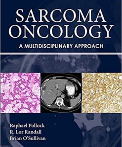 (eBook PDF) Sarcoma Oncology: A Multidisciplinary Approach