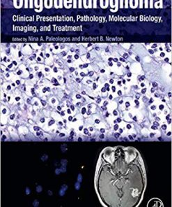 (eBook PDF) Oligodendroglioma: Clinical Presentation, Pathology, Molecular Biology, Imaging, and Treatment