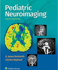 (eBook PDF) Pediatric Neuroimaging 6th Edition by A. James Barkovich