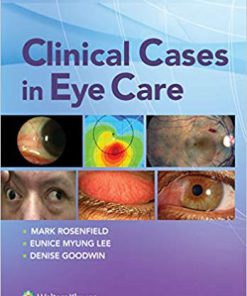 (eBook PDF) Clinical Cases in Eye Care by Mark Rosenfield