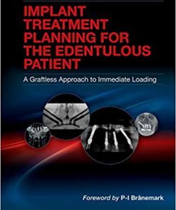 (eBook PDF) Implant Treatment Planning for the Edentulous Patient: A Graftless Approach to Immediate Loading