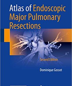 (eBook PDF) Atlas of Endoscopic Major Pulmonary Resections 2nd Edition