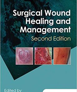 (eBook PDF) Surgical Wound Healing and Management 2nd Edition