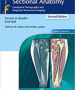 (eBook PDF) Pocket Atlas of Sectional Anatomy, Volume 3: Spine, Extremities, Joints: Computed Tomography and Magnetic Resonance Imaging 2nd Edition