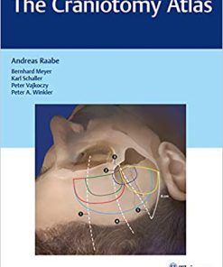 (eBook PDF) The Craniotomy Atlas