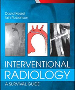 (eBook PDF) Interventional Radiology: A Survival Guide 4th Edition