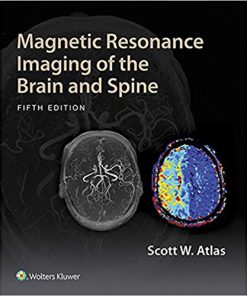 (eBook PDF) Magnetic Resonance Imaging of the Brain and Spine 5th Editio