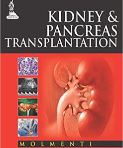 (eBook PDF) Kidney and Pancreas Transplantation