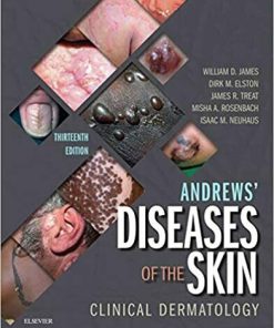 Andrews' Diseases of the Skin: Clinical Dermatology 13th Edition (eBook PDF)