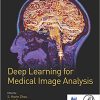 (eBook PDF) Deep Learning for Medical Image Analysis by S. Kevin Zhou