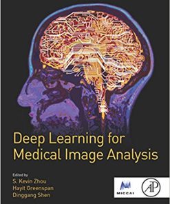 (eBook PDF) Deep Learning for Medical Image Analysis by S. Kevin Zhou
