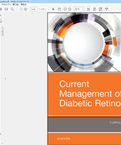 (Original PDF) Current Management of Diabetic Retinopathy
