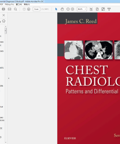 (Original PDF) The Anterior Cruciate Ligament Reconstruction and Basic Science
