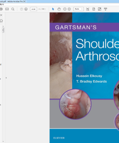 (Original PDF) Gartsmans Shoulder Arthroscopy E-Book