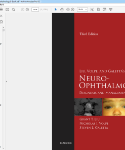 (Original PDF) Liu, Volpe, and Galetta's Neuro-Ophthalmology E-Book