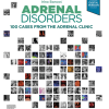 Adrenal Disorders ,100 Cases from the Adrenal Clinic - eBook PDF