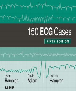 150 ECG Cases (Fifth Edition) John Hampton - eBook PDF