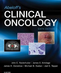 Abeloff's Clinical Oncology - eBook PDF