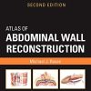 Atlas of Abdominal Wall Reconstruction 2nd Edition Michael J. Rosen - eBook PDF