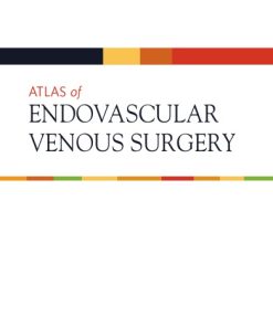 Atlas of Endovascular Venous Surgery 2nd ed. Edition Almeida - eBook PDF