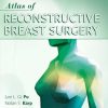 Atlas of Reconstructive Breast Surgery 1st Edition Lee L. Q. Pu - eBook PDF