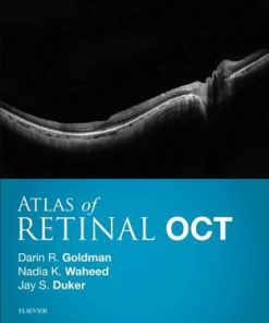 Atlas of Retinal OCT: Optical Coherence Tomography 1st Edition Darin Goldman - eBook PDF