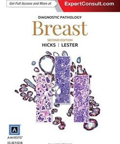 Breast 2nd Edition Susan C. Lester - eBook PDF