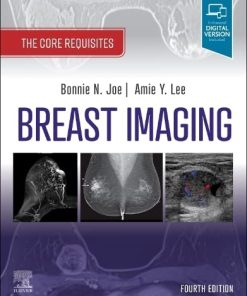 Breast Imaging: The Core Requisites 4th Edition Bonnie N. Joe - eBook PDF