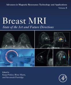 Breast MRI: State of the Art and Future Directions 1st Edition Katja Pinker (Editor) - eBook PDF