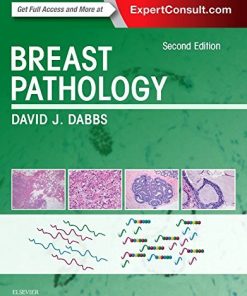 Breast Pathology 2nd Edition David J Dabbs - eBook PDF
