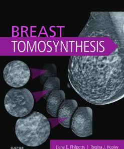 Breast Tomosynthesis 1st Edition Liane E Philpotts Md  Facr - eBook PDF