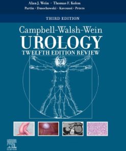 Campbell-Walsh Urology 12th Edition Review Alan Wein - eBook PDF