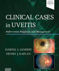 Clinical Cases in Uveitis 1st Edition  - eBook PDF