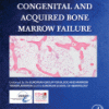 Congenital and Acquired Bone Marrow Failure 1st Edition Edition Mahmoud Aljurf - eBook PDF