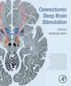 Connectomic Deep Brain Stimulation 1st Edition Andreas Horn - eBook PDF