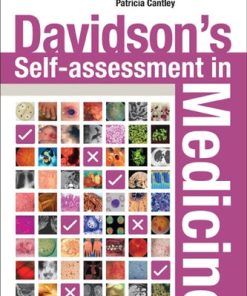 Davidson's Self-assessment in Medicine 1st Edition Deborah Wake - eBook PDF