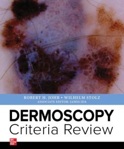 Dermoscopy Criteria Review 1st Edition Robert Johr - eBook PDF