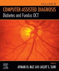 Diabetes and Fundus OCT (Computer-Assisted Diagnosis) 1st edition - eBook PDF