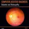 Diabetes and Retinopathy 1st Edition Ayman S. El-Baz - eBook PDF