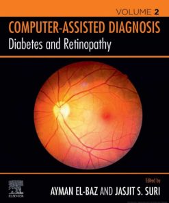 Diabetes and Retinopathy: Computer-Assisted Diagnosis Volume 2 1st Edition Ayman S. El-Baz - eBook PDF