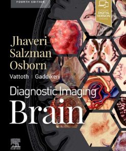 Diagnostic Imaging: Brain 4th Edition Miral D. Jhaveri - eBook PDF