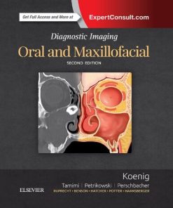 Diagnostic Imaging : Oral And Maxillofacial. 2nd Edition Lisa J. Koenig - eBook PDF