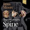 Diagnostic Imaging: Spine 4th Edition Jeffrey S. Ross Md And Kevin R. Moore Md Author - eBook PDF