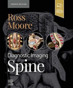 Diagnostic Imaging: Spine 4th Edition Jeffrey S. Ross Md And Kevin R. Moore Md Author - eBook PDF