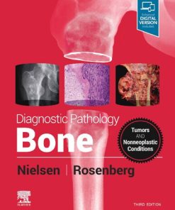 Diagnostic Pathology: Bone, 3rd Edition Gunnlaugur Petur Nielsen - eBook PDF