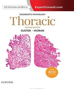 Diagnostic Pathology: Thoracic 2nd Edition Saul Suster - eBook PDF
